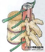 腰腿疼痛的治疗误区