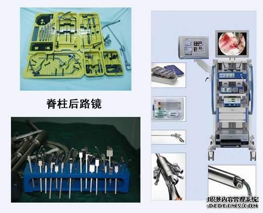 脊柱后路镜